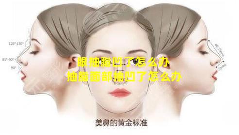 眼抽脂凹了怎么办 抽脂面部抽凹了怎么办